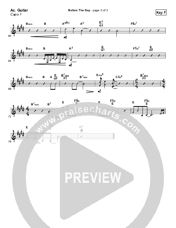 Before The Day Acoustic Guitar (Newsong)