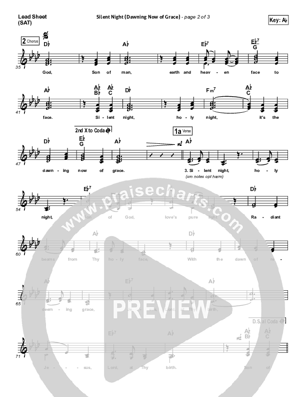 Silent Night (Dawning Now Of Grace) Lead Sheet (SAT) (Essential Worship)