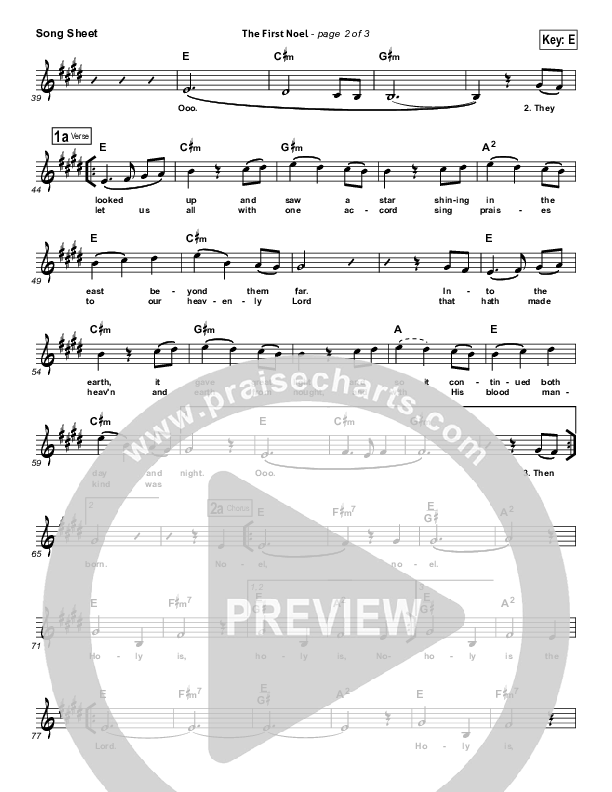 The First Noel (Holy Is The Lord) Lead (SAT) (Hillsong Worship)