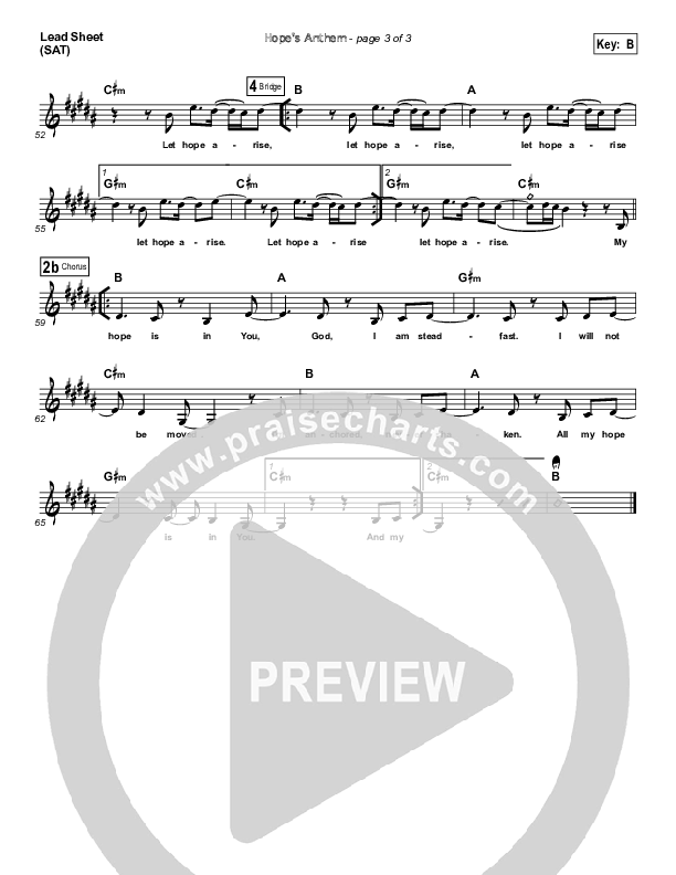 Hope's Anthem Lead Sheet (SAT) (Bethel Music)