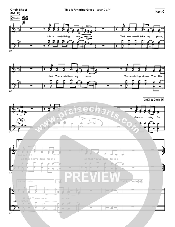 This Is Amazing Grace Choir Vocals (SATB) (Bethel Music)