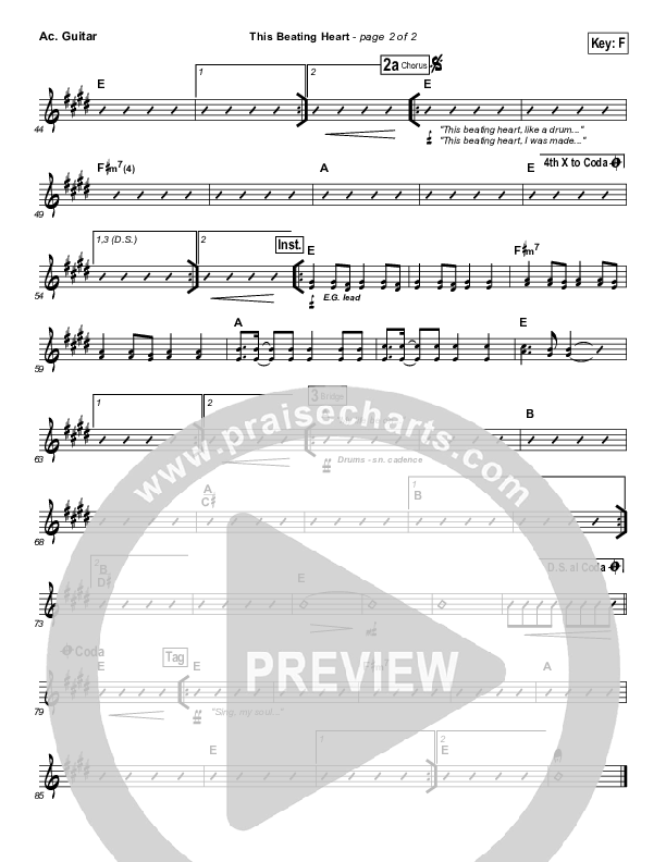 This Beating Heart Acoustic Guitar (Matt Redman)