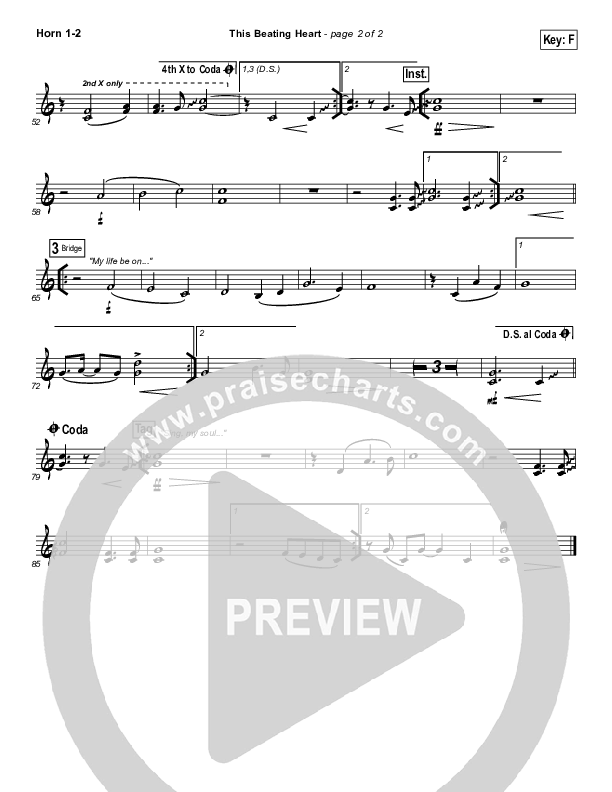 This Beating Heart Brass Pack (Matt Redman)