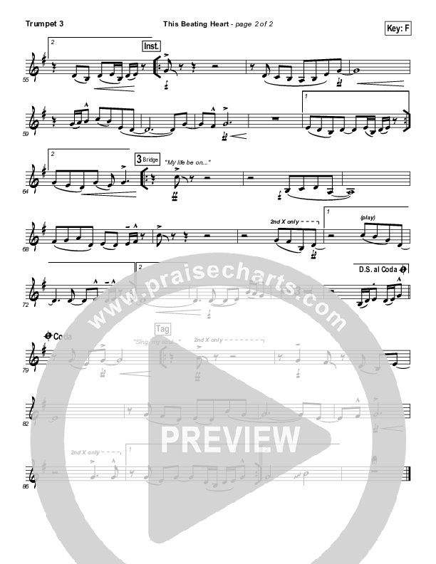 This Beating Heart Trumpet 3 (Matt Redman)