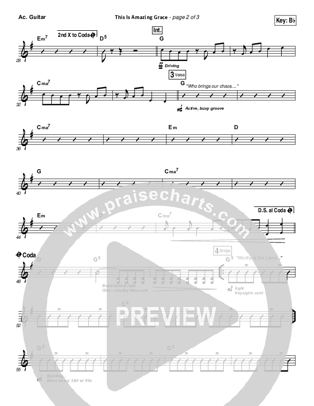 This Is Amazing Grace Acoustic Guitar (Phil Wickham)