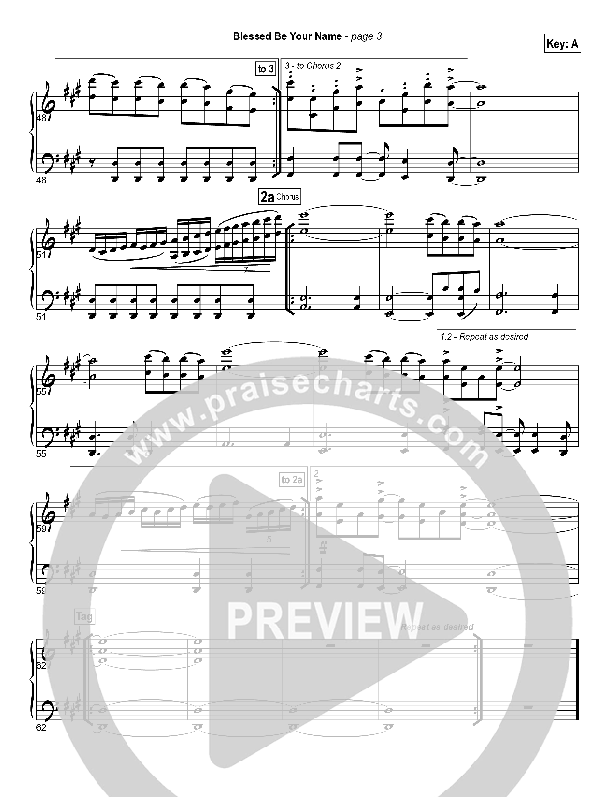 Blessed Be Your Name String Reduction (Matt Redman)