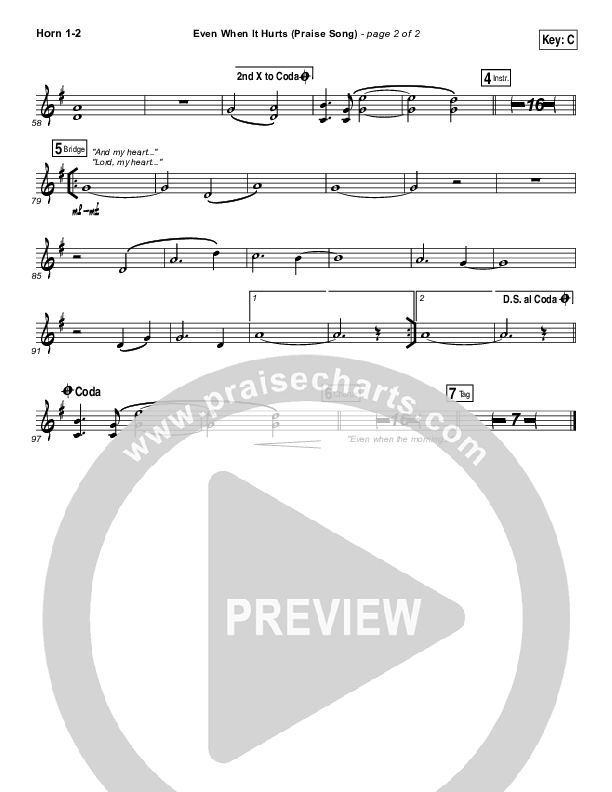 Even When It Hurts (Praise Song) Brass Pack (Hillsong UNITED)