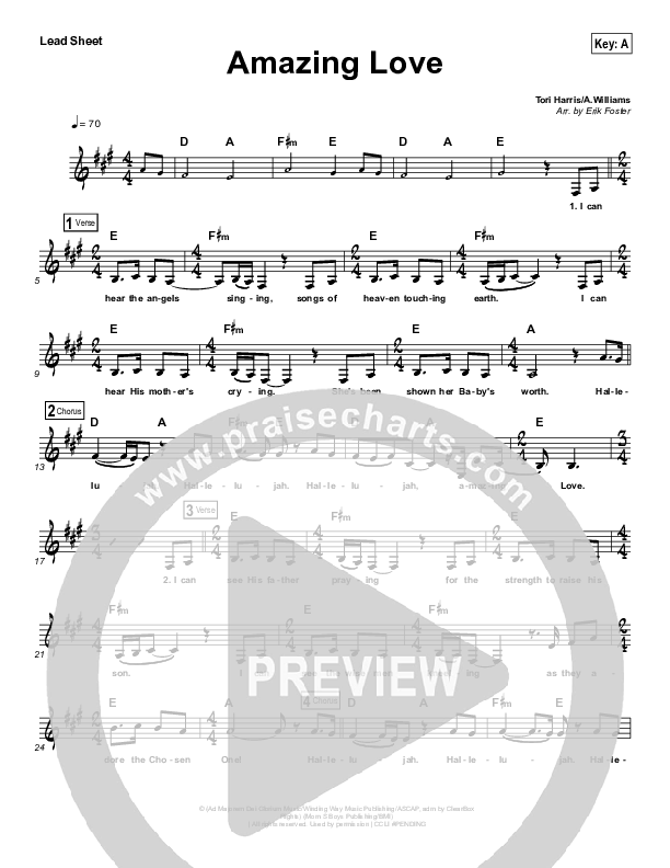 Amazing Love Lead Sheet (Vital Worship)