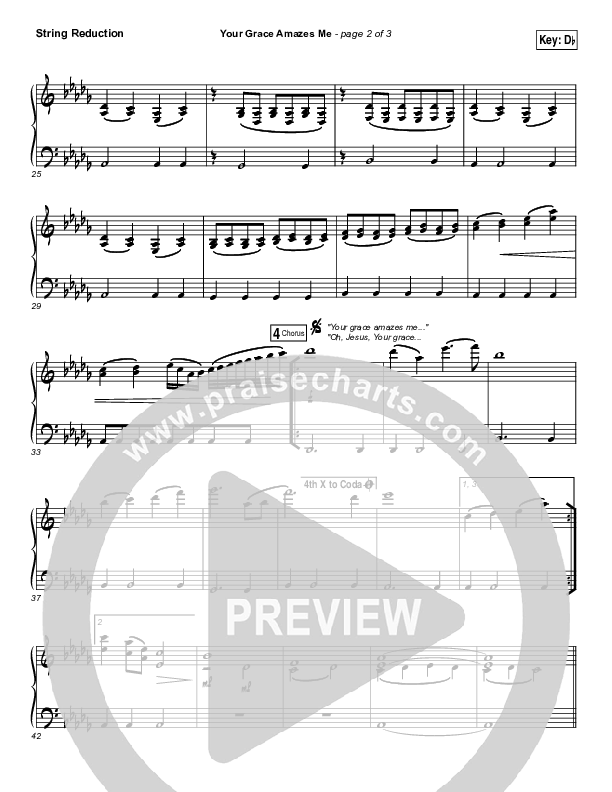 Your Grace Amazes Me String Pack (Christy Nockels / Passion)