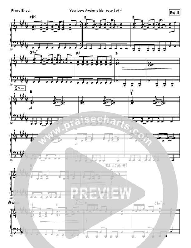 Your Love Awakens Me Piano Sheet (Phil Wickham)