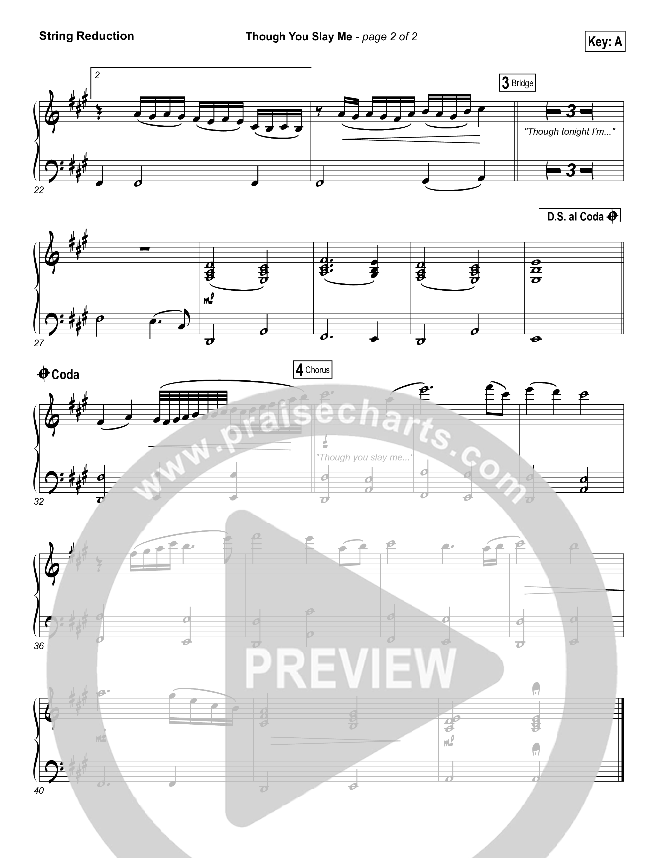 Though You Slay Me String Reduction (Shane & Shane / The Worship Initiative)