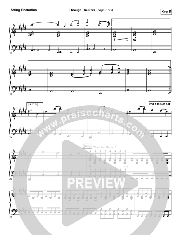 Through The Dark String Pack (Madaline Garcia)