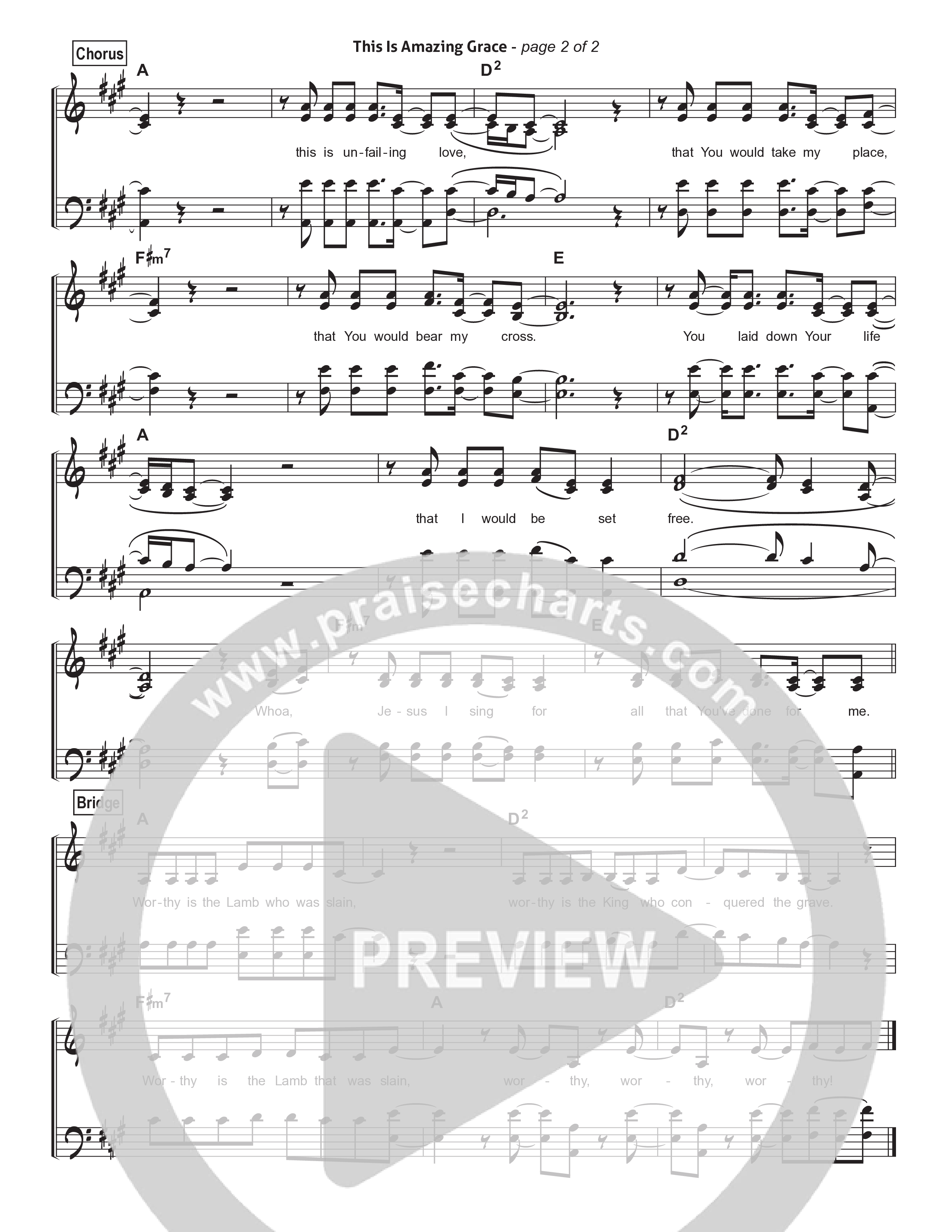 This Is Amazing Grace Hymn Sheet (Phil Wickham)