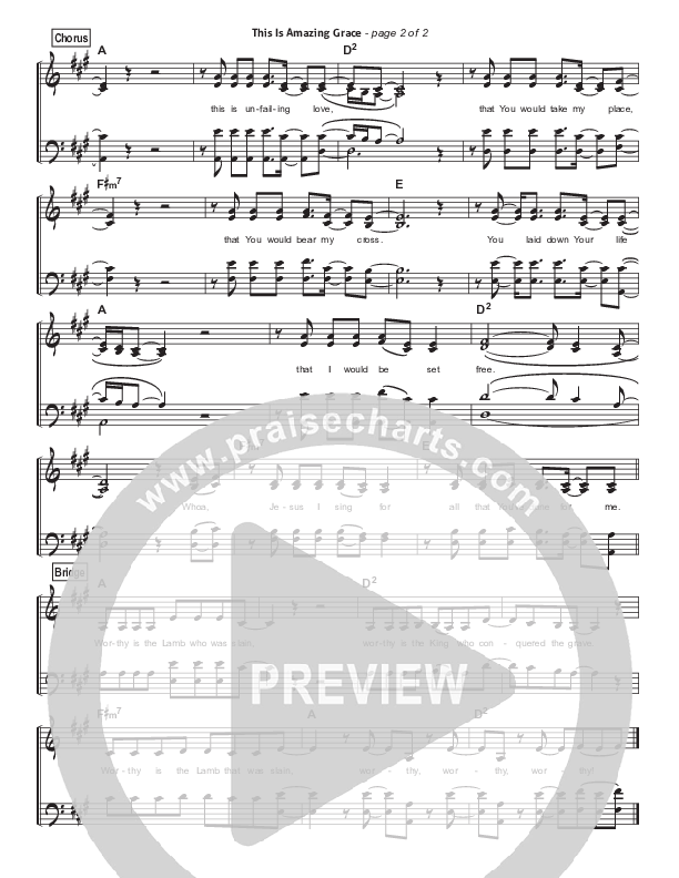 This Is Amazing Grace Hymn Sheet (SATB) (Phil Wickham)