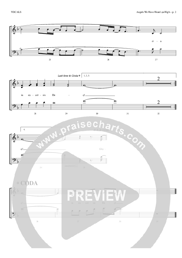 Angels We Have Heard on High Choir Sheet (Todd Billingsley)