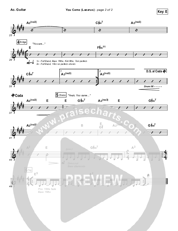 You Came (Lazarus) Acoustic Guitar (Bethel Music / Melissa Helser)