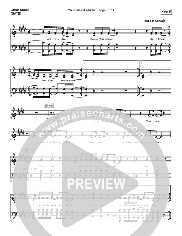 You Came (Lazarus) Choir Sheet (SATB) (Bethel Music / Melissa Helser)