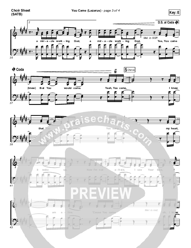 You Came (Lazarus) Choir Sheet (SATB) (Bethel Music / Melissa Helser)