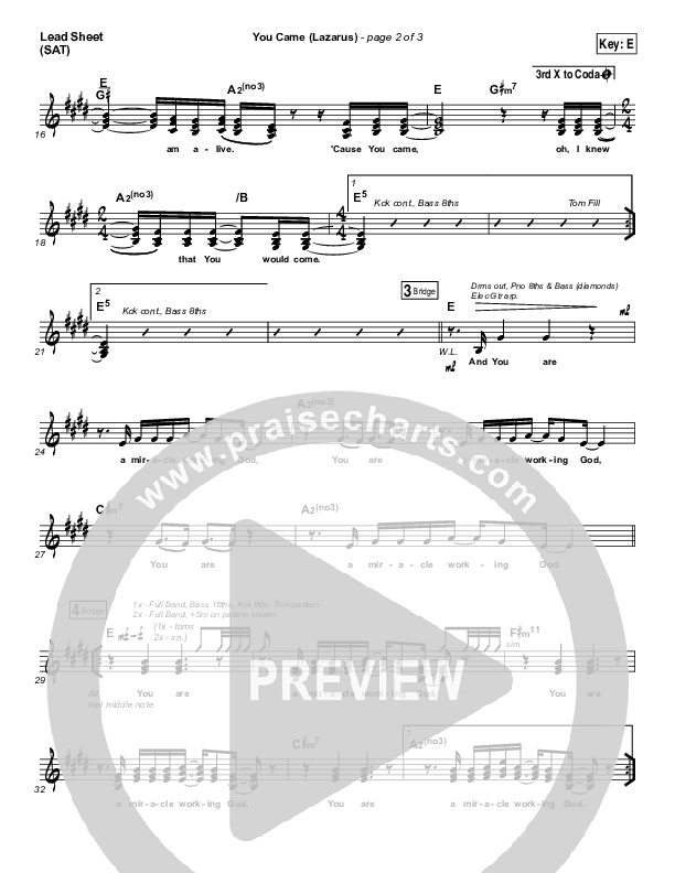 You Came (Lazarus) Lead Sheet (SAT) (Bethel Music / Melissa Helser)