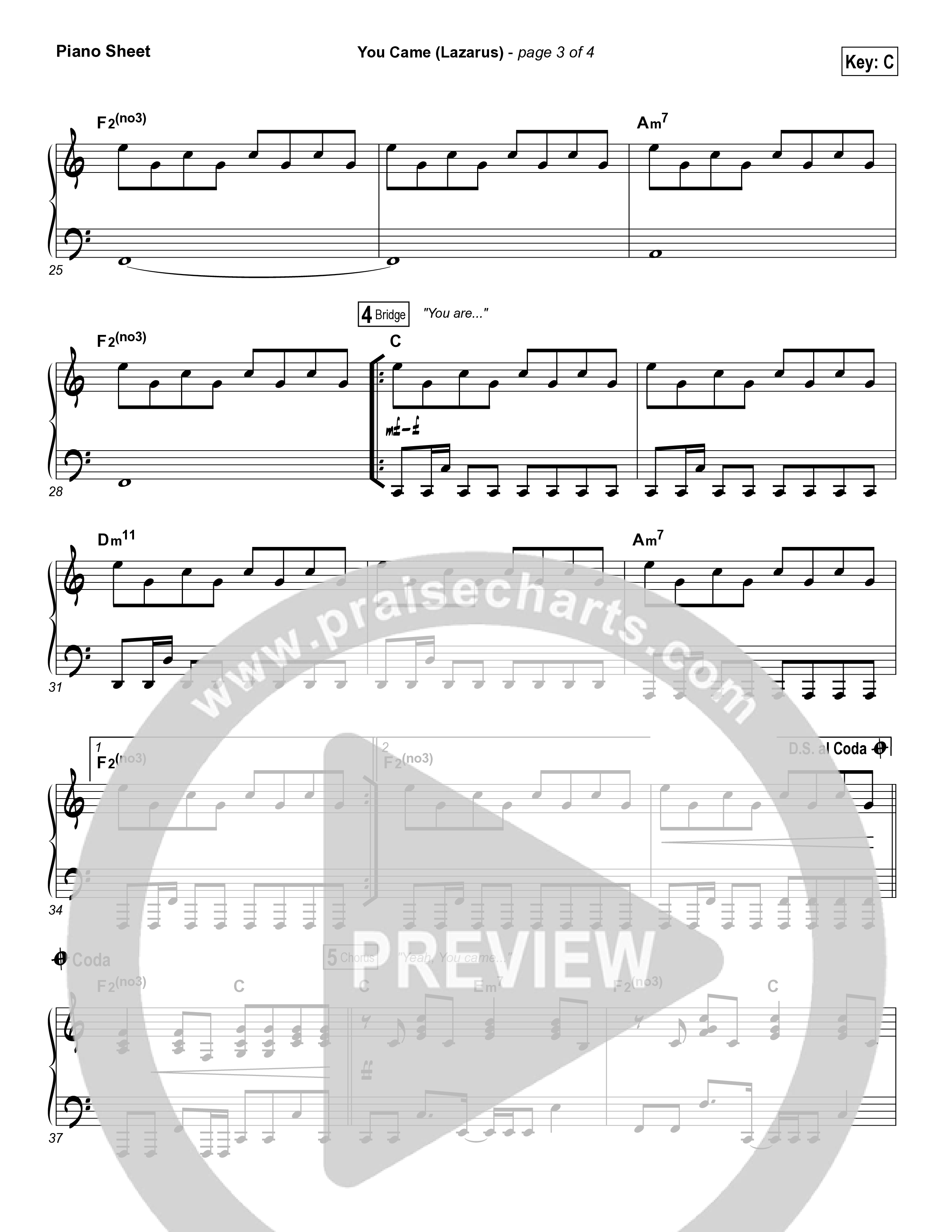 You Came (Lazarus) Piano Sheet (Bethel Music / Melissa Helser)