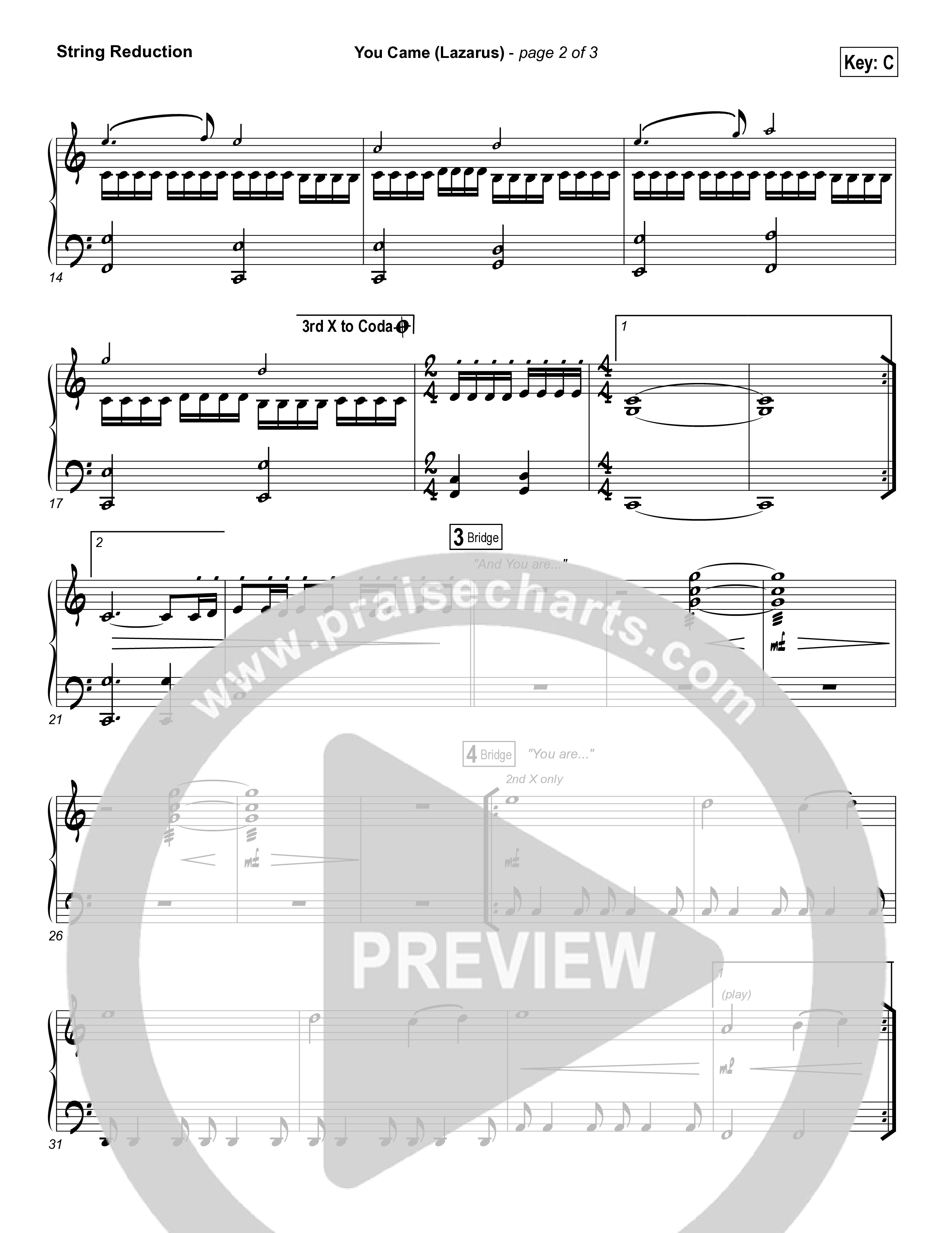 You Came (Lazarus) String Reduction (Bethel Music / Melissa Helser)