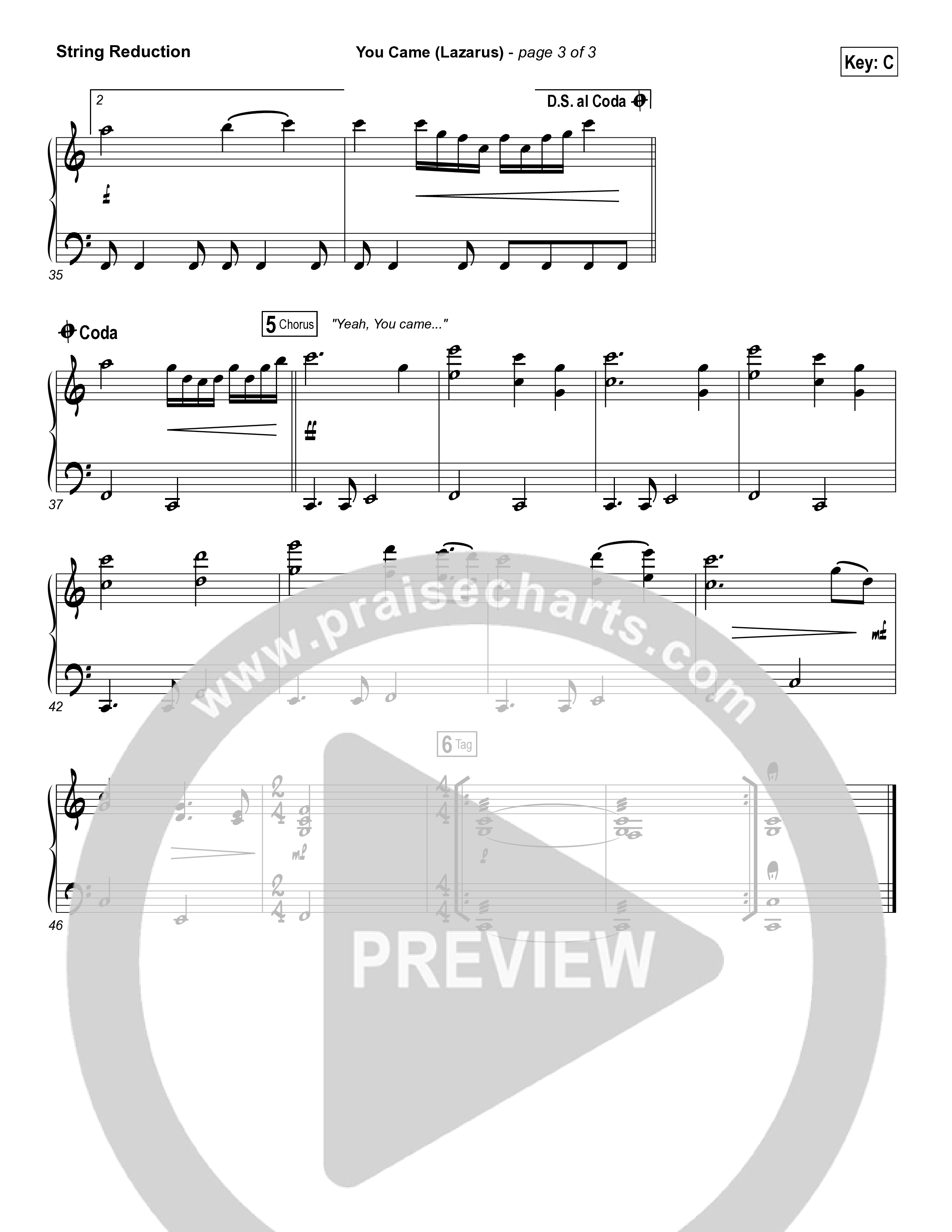 You Came (Lazarus) String Reduction (Bethel Music / Melissa Helser)