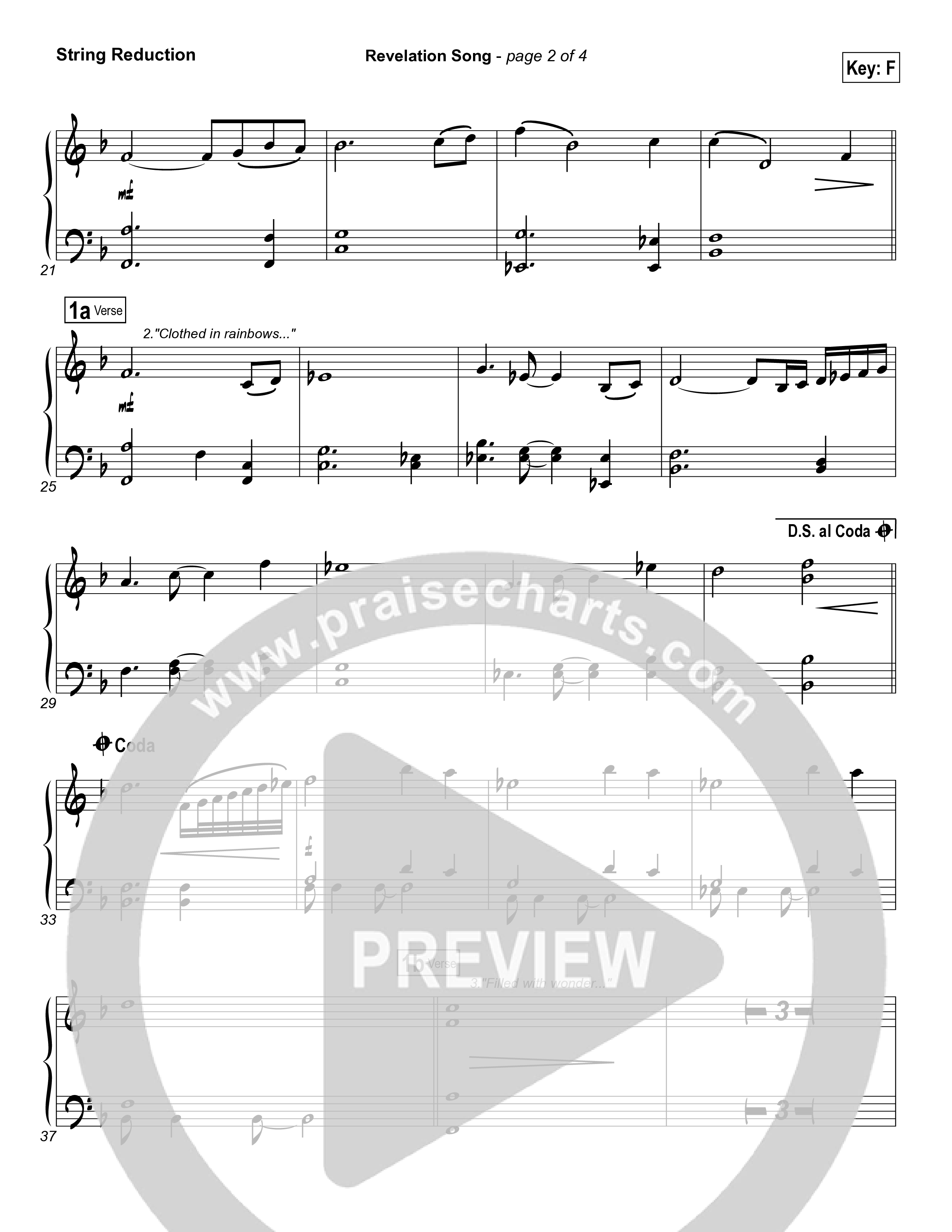 Revelation Song String Reduction (Phillips Craig & Dean)