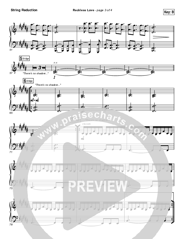 Reckless Love (YouTube) Synth Strings (Steffany Gretzinger)