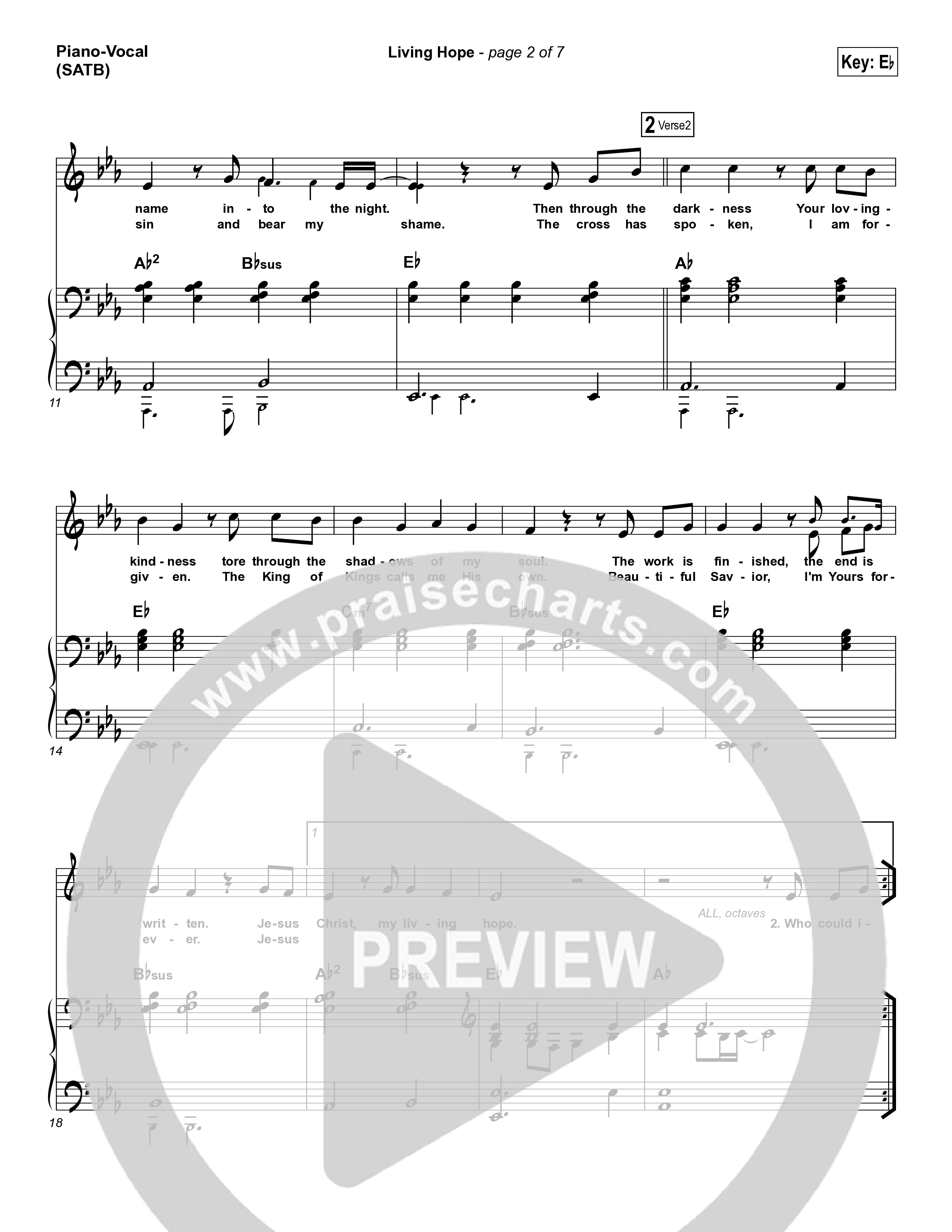 Living Hope Piano/Vocal (SATB) (Phil Wickham)