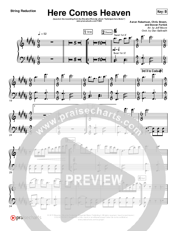 Here Comes Heaven String Pack (Elevation Worship)