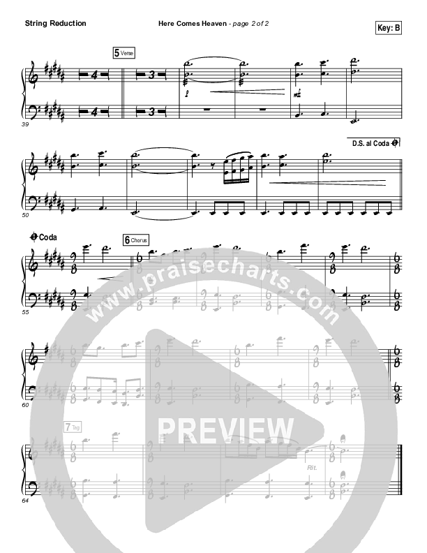 Here Comes Heaven String Pack (Elevation Worship)