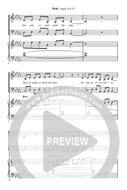 Noel (Choral Anthem SATB) Octavo (SATB & Pno) (Lauren Daigle / Arr. Luke Gambill)