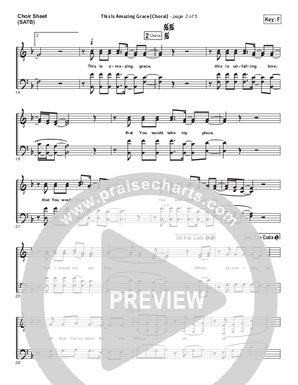 This Is Amazing Grace (Choral Anthem SATB) Choir Vocals (SATB) (Phil Wickham / Arr. Luke Gambill)