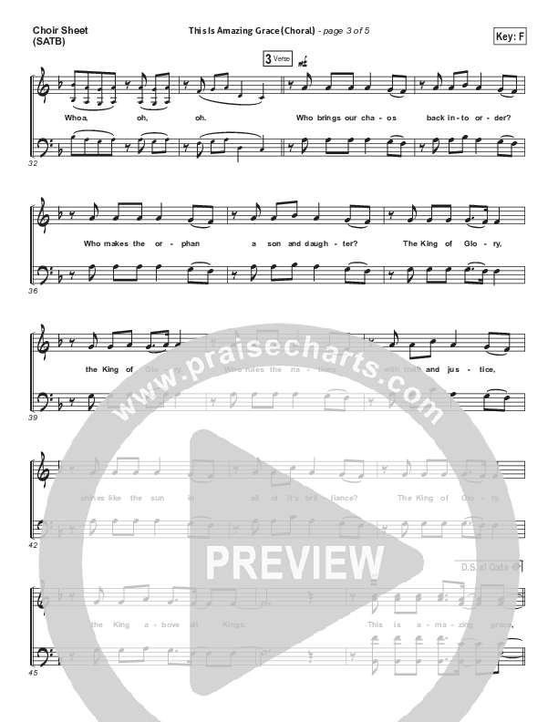 This Is Amazing Grace (Choral Anthem SATB) Choir Vocals (SATB) (Phil Wickham / Arr. Luke Gambill)