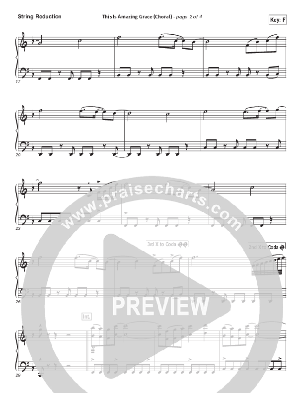 This Is Amazing Grace (Choral Anthem SATB) Synth Strings (Phil Wickham / Arr. Luke Gambill)