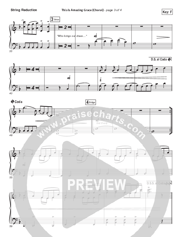 This Is Amazing Grace (Choral Anthem SATB) Synth Strings (Phil Wickham / Arr. Luke Gambill)