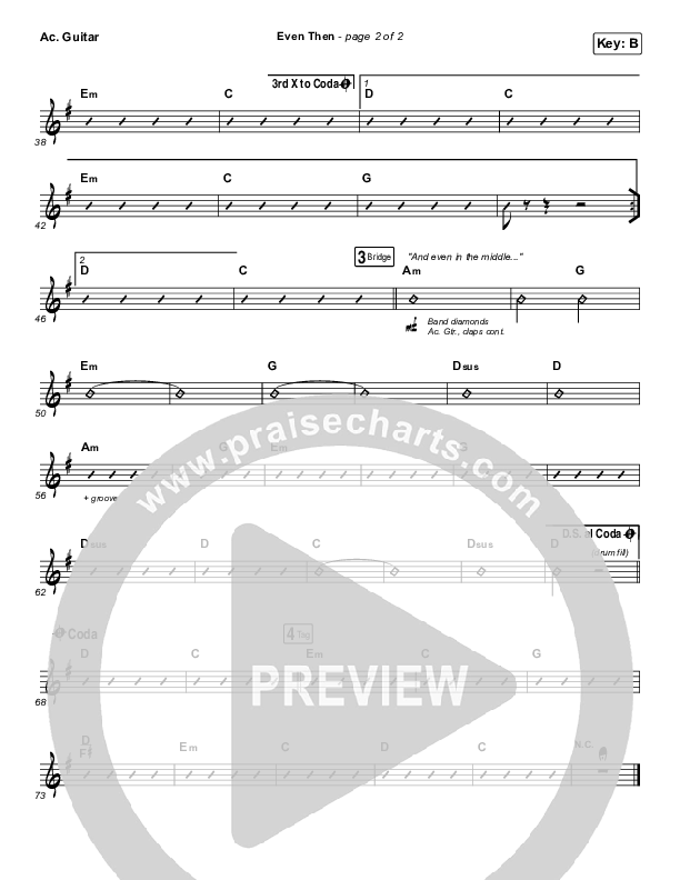 Even Then Acoustic Guitar (Micah Tyler)