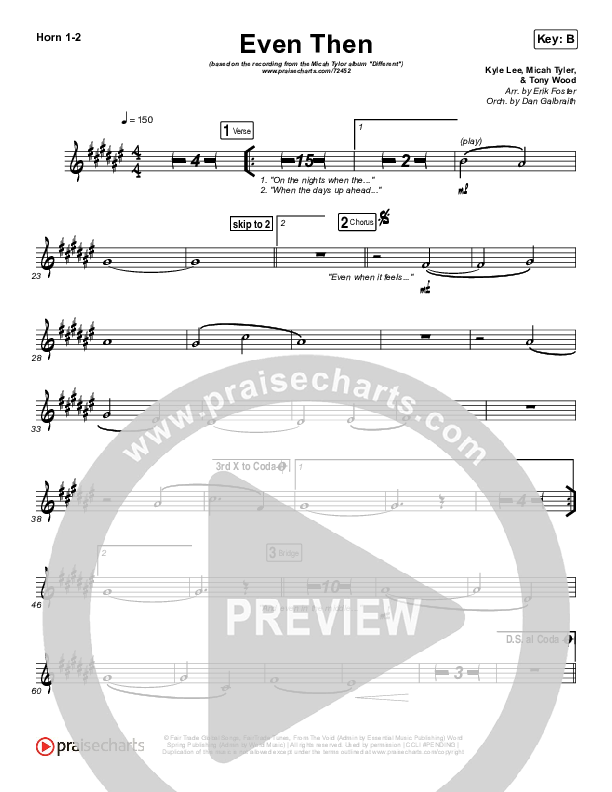 Even Then Brass Pack (Micah Tyler)