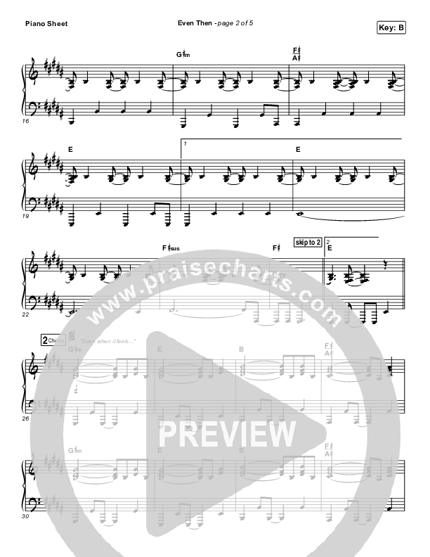 Even Then Piano Sheet (Micah Tyler)