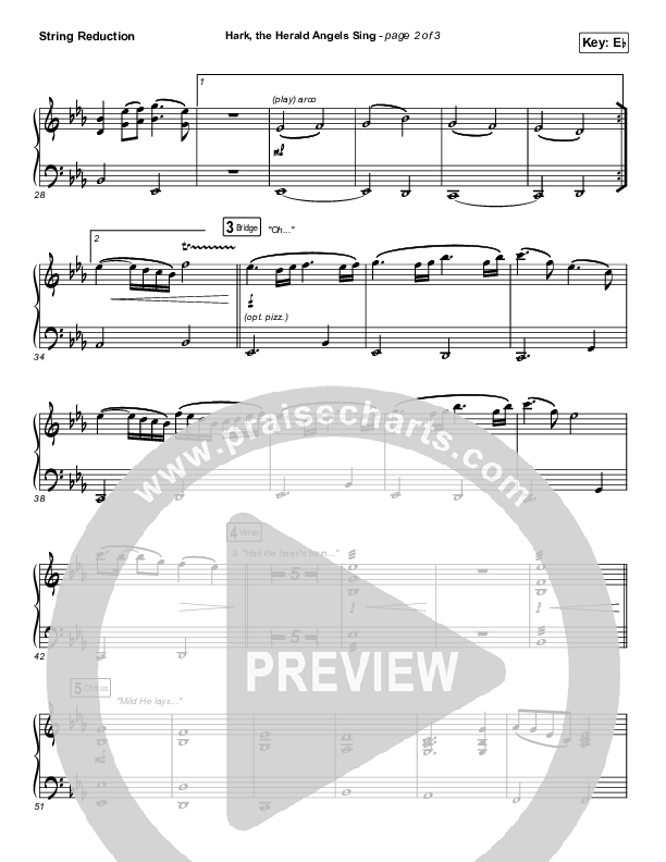 Hark The Herald Angels Sing String Reduction (Phil Wickham)