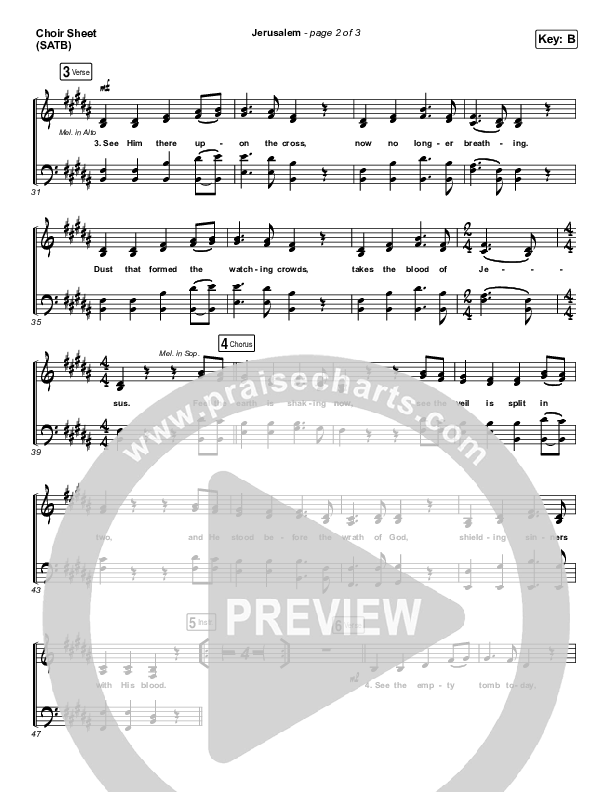 Jerusalem Choir Vocals (SATB) (CityAlight)