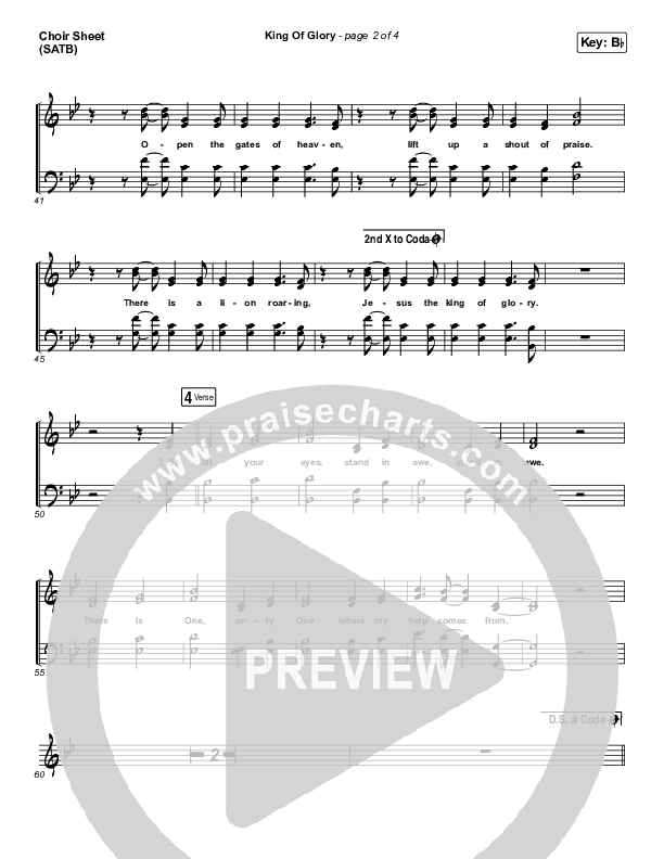 King Of Glory (Live) Choir Vocals (SATB) (Passion)