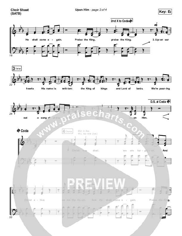 Upon Him (Live) Choir Vocals (SATB) (Matt Redman)