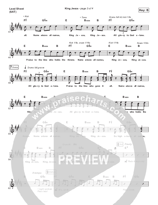 King Jesus (Live) Lead Sheet (SAT) (Matt Redman)