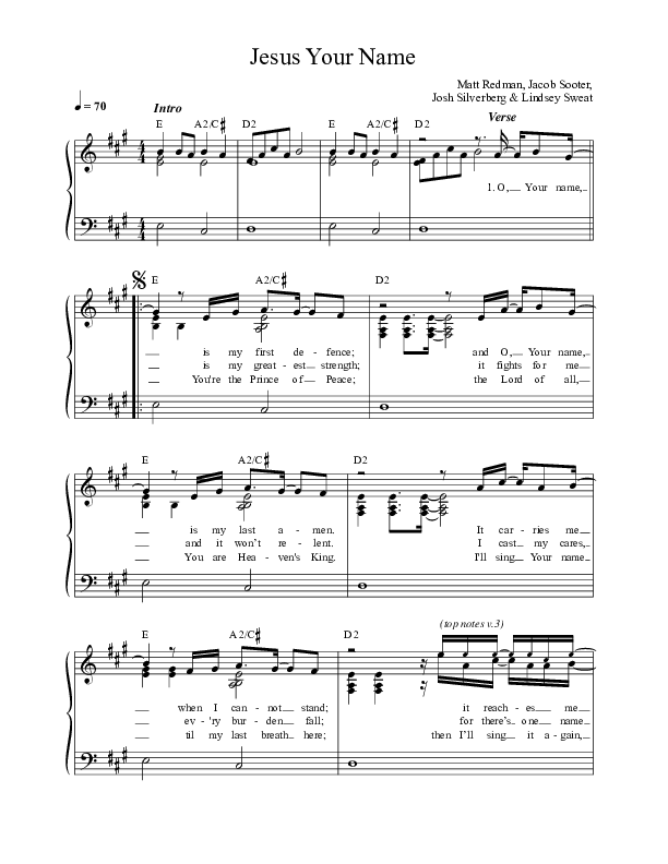 Jesus Your Name (Live) Lead Sheet (Matt Redman)