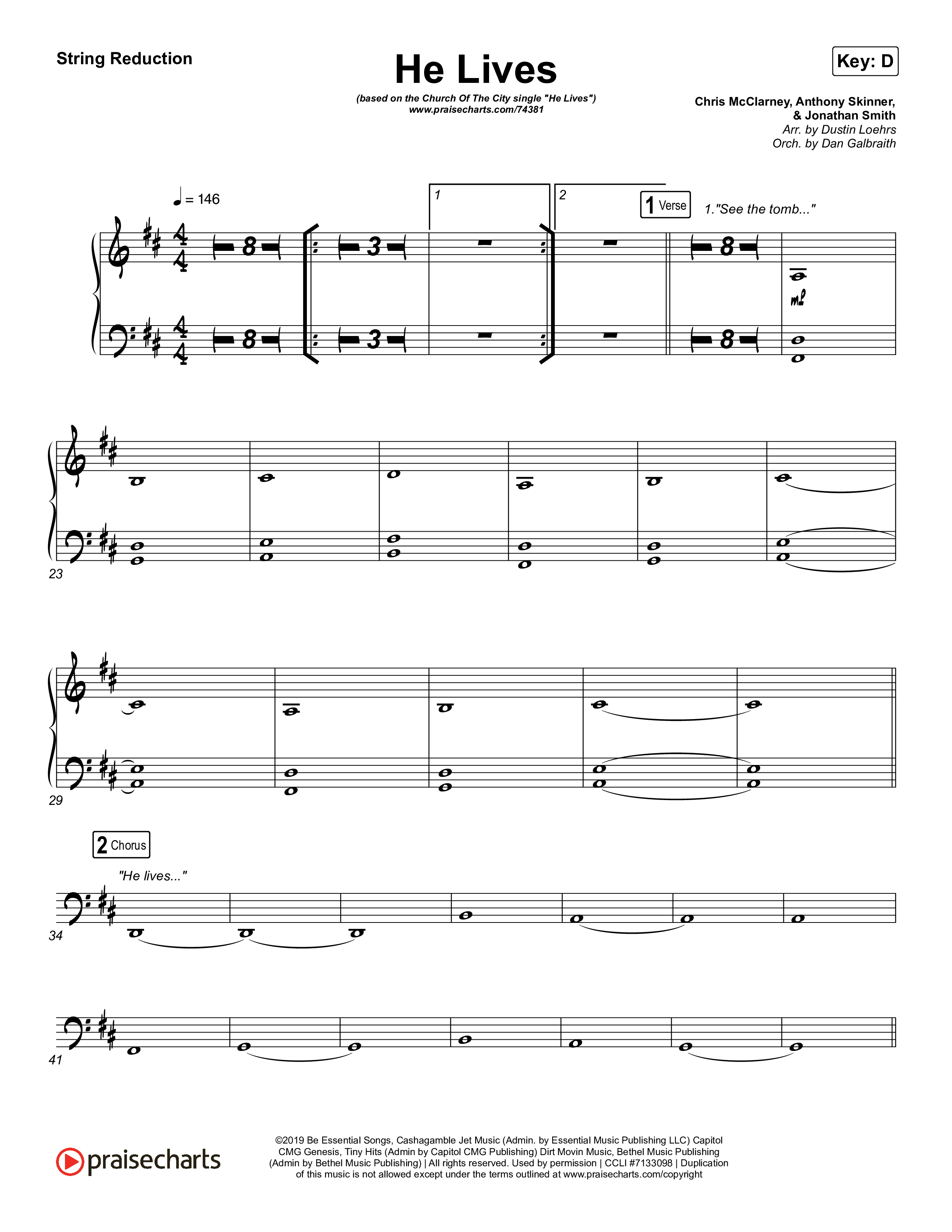 He Lives (Live) String Reduction (Church Of The City)