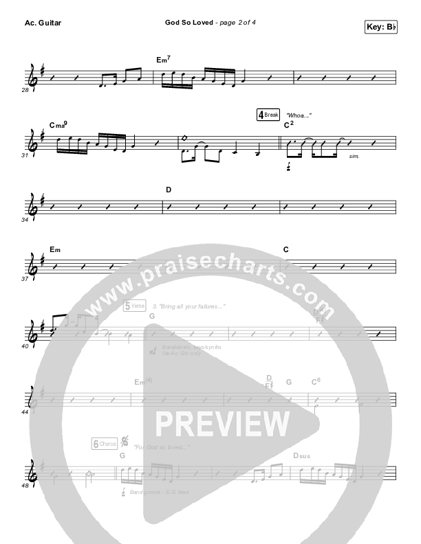 God So Loved Acoustic Guitar (We The Kingdom)