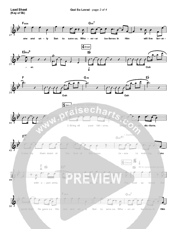 God So Loved Lead Sheet (Melody) (We The Kingdom)