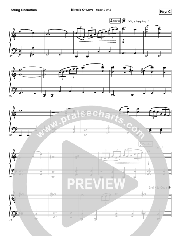 Miracle Of Love String Reduction (Chris Tomlin)