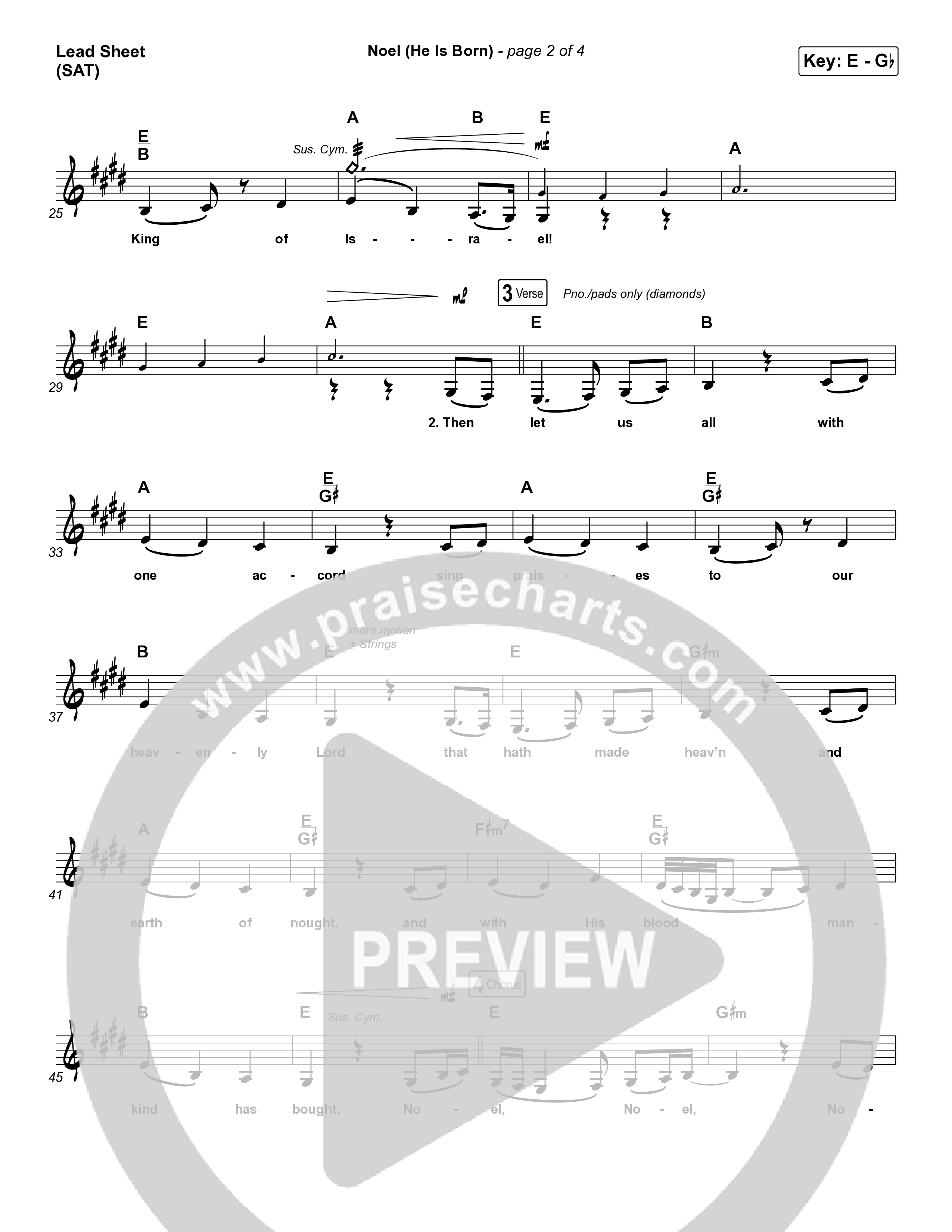 Noel (He Is Born) Lead Sheet (SAT) (Tommee Profitt / Stanaj)
